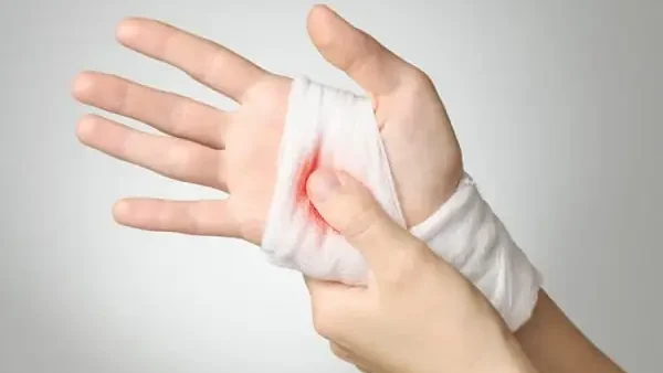 Giải Mã Bị Đứt Tay Ngón Trỏ Là Điềm Gì Theo Tâm Linh Và Cách Xử Lý An Toàn