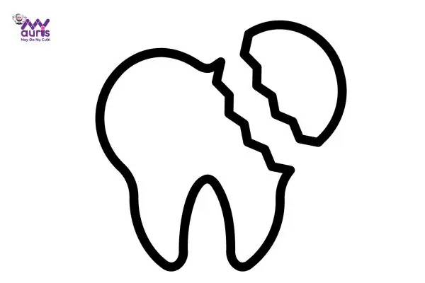 Tình Trạng Mẻ Răng Hàm Dưới Phổ Biến Hiện Nay Tình Trạng Mẻ Răng Hàm Dưới Phổ Biến Hiện Nay