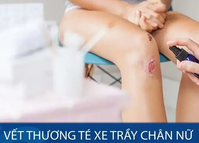 Ý Nghĩa Các Điềm Báo Khi Bất Ngờ Bị Ngã Xe Trong Đời Thực Là Gì? Ý Nghĩa Các Điềm Báo Khi Bất Ngờ Bị Ngã Xe Trong Đời Thực Là Gì?