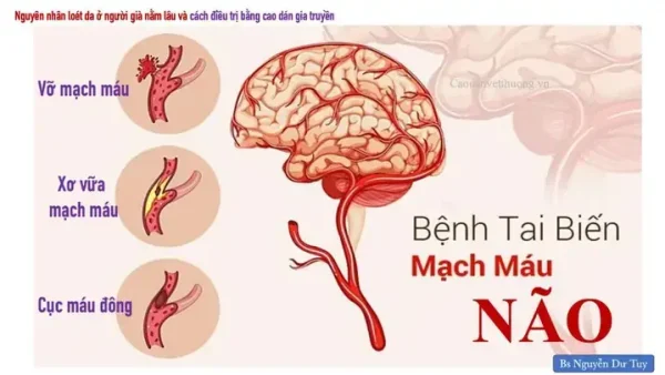 Hướng Dẫn Cúng Cho Người Bệnh Nằm Lâu Toàn Diện: Lễ Vật, Văn Khấn, Nghi Thức Theo Từng Tình Huống