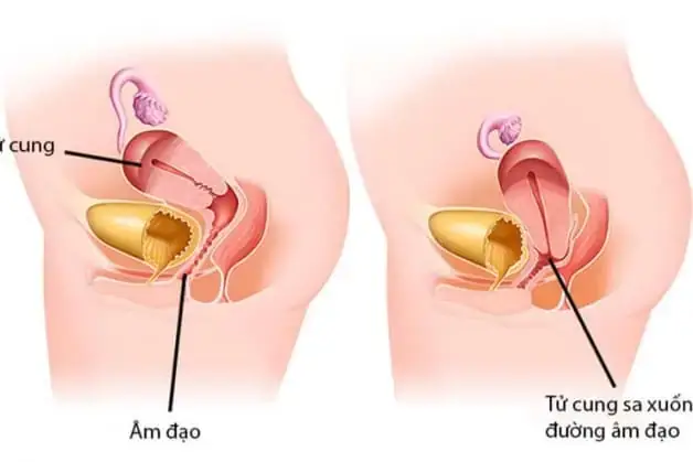 Cúng Sả Có Sao Không? Ý Nghĩa, Nghi Lễ Chuẩn & Phân Biệt Với "thủ Cung Sa"