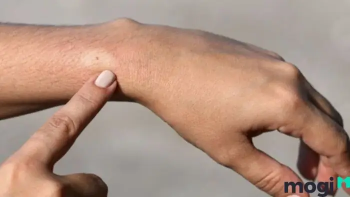 Ý Nghĩa Điềm Báo Khi Bị Ong Đốt Vào Từng Thời Điểm Cụ Thể Đầu Năm