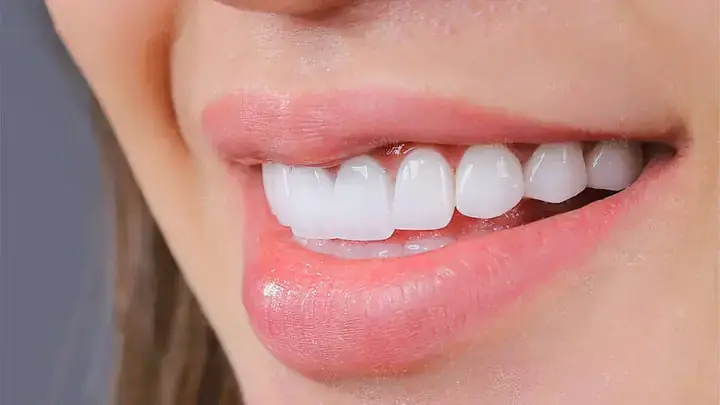 Làm Thế Nào Để Chăm Sóc Và Bảo Vệ Răng Miệng Đúng Cách Sau Khi Điều Trị Đau Răng? Làm Thế Nào Để Chăm Sóc Và Bảo Vệ Răng Miệng Đúng Cách Sau Khi Điều Trị Đau Răng?