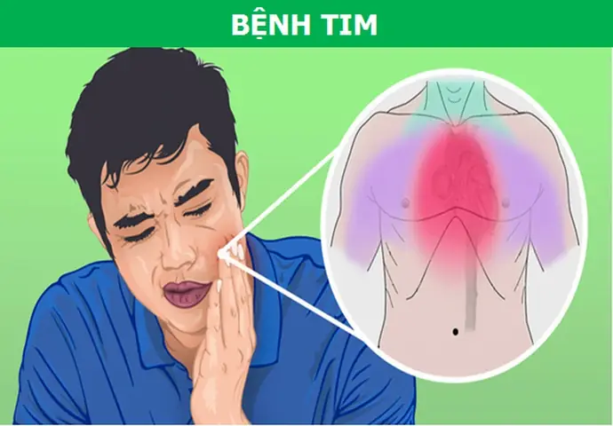 Đau Nhức Răng Dữ Dội Vào Ban Đêm Cảnh Báo Điều Gì? Đau Nhức Răng Dữ Dội Vào Ban Đêm Cảnh Báo Điều Gì?