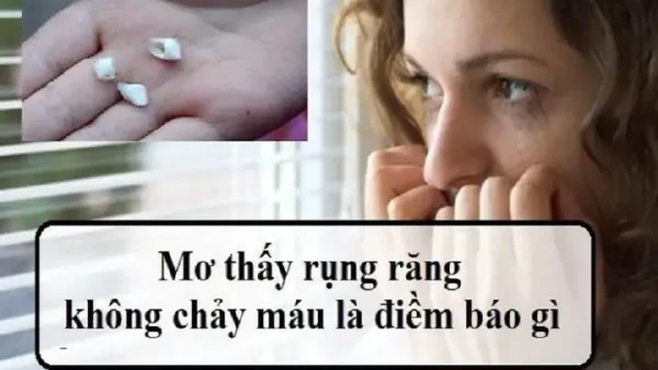 Đau Răng Là Điềm Báo Gì Về Sức Khỏe Và Tâm Linh Theo Góc Nhìn Chuyên Gia