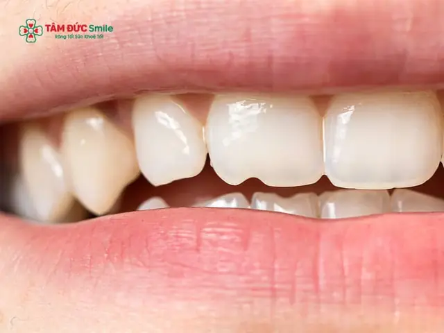 Điềm Báo Dưới Góc Nhìn Tâm Linh Và Khoa Học Thực Tế Điềm Báo Dưới Góc Nhìn Tâm Linh Và Khoa Học Thực Tế