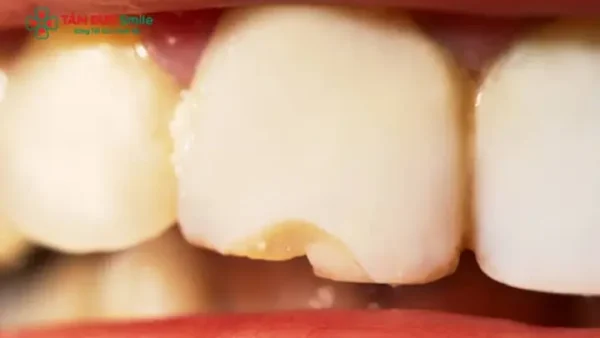 Tổng Hợp Điềm Báo Dân Gian Phổ Biến Nhất Và Cách Nhận Biết Điềm Lành Điềm Dữ