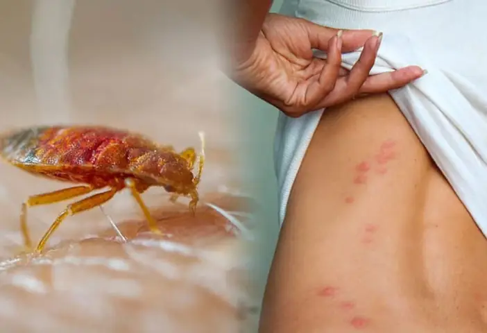 Gián Bò Lên Người Là Điềm Lành Hay Điềm Dữ? Gián Bò Lên Người Là Điềm Lành Hay Điềm Dữ?