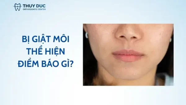 Giải Mã Điềm Báo Giật Cơ Pháp Lệnh: Ý Nghĩa Nhân Tướng Học Và Góc Nhìn Y Khoa