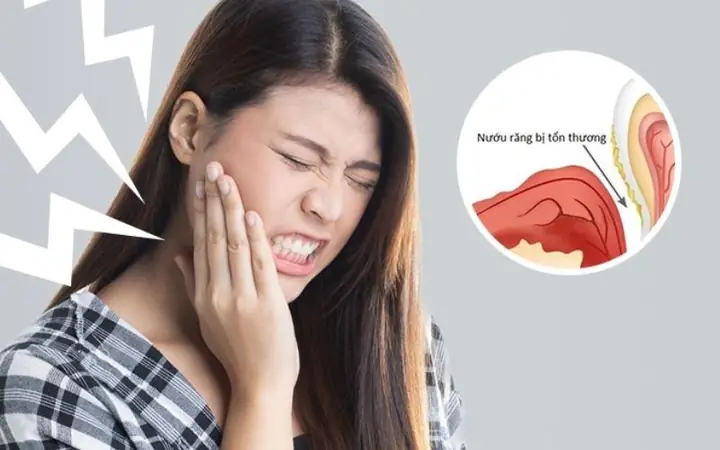 Tại Sao Mọc Răng Khôn Lại Gây Đau Đớn Và Kéo Dài Bao Lâu? Tại Sao Mọc Răng Khôn Lại Gây Đau Đớn Và Kéo Dài Bao Lâu?