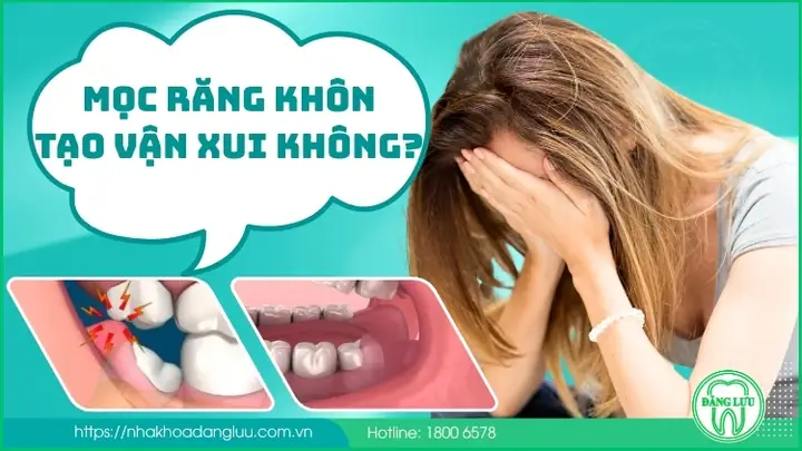 Mọc Răng Khôn Có Phải Là Điềm Báo Vận Xui Như Nhiều Người Lo Lắng Không? Mọc Răng Khôn Có Phải Là Điềm Báo Vận Xui Như Nhiều Người Lo Lắng Không?
