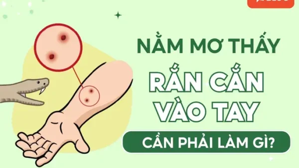 Giải Mã Điềm Báo Kim Đâm Vào Tay: Ý Nghĩa Tâm Linh Và Những Lưu Ý Cần Biết