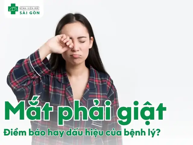 Minh Họa Hiện Tượng Giật Mắt Phải Theo Quan Niệm Dân Gian Minh Họa Hiện Tượng Giật Mắt Phải Theo Quan Niệm Dân Gian