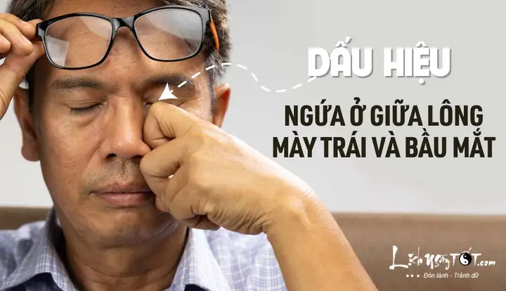 Vị Trí Giữa Lông Mày Trái Và Bầu Mắt Ngứa Ngáy Báo Hiệu Điều Gì?