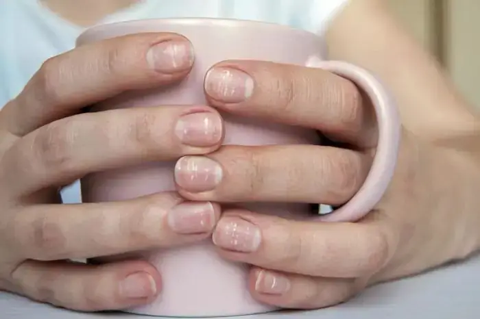 Các Hiện Tượng Bất Thường Thường Gặp Ở Móng Chân Cảnh Báo Điều Gì?