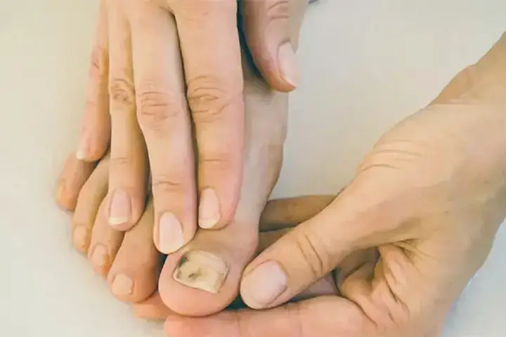 Móng Chân Nhẵn Nhụi, Sạch Sẽ Bẩm Sinh Mang Ý Nghĩa Gì Về Hậu Vận?