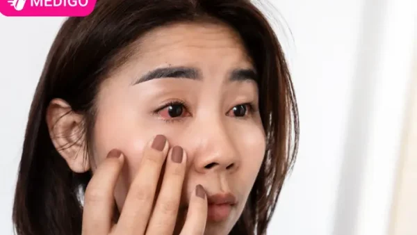 Điềm Báo Ngứa Mắt Là Gì? Giải Mã Dưới Góc Nhìn Tâm Linh Và Y Học