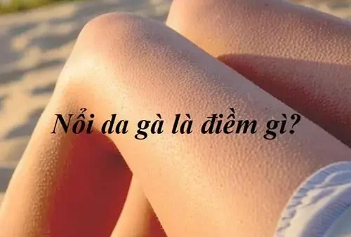 Giải Mã Hiện Tượng Nổi Da Gà Là Điềm Báo Gì, Tốt Hay Xấu Theo Tâm Linh?