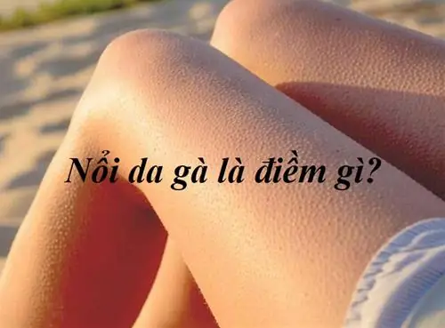 Giải Mã Hiện Tượng Nổi Da Gà Là Điềm Báo Gì, Tốt Hay Xấu Theo Tâm Linh?