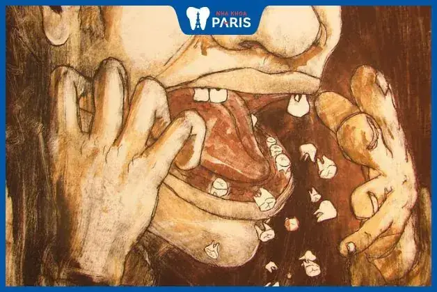 Ý Nghĩa Điềm Báo Răng Vỡ Vụn Thay Đổi Như Thế Nào Theo Vị Trí Và Trạng Thái?
