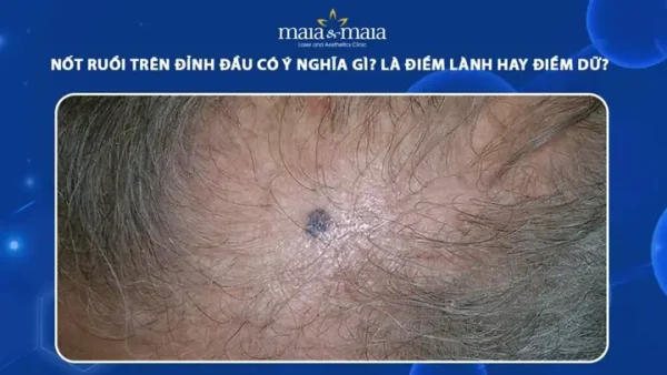 Điềm Lành Là Gì? Giải Mã Ý Nghĩa Và Các Dấu Hiệu Nhận Biết Trong Đời Sống