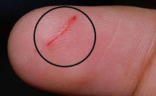 Hiện Tượng Đứt Tay Chảy Máu Mang Điềm Báo Xấu Về Sự Bất Cẩn