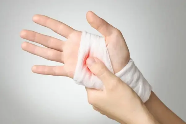 Giấc Mơ Đứt Tay Chảy Máu Có Liên Quan Đến Con Số May Mắn Nào Không? Giấc Mơ Đứt Tay Chảy Máu Có Liên Quan Đến Con Số May Mắn Nào Không?