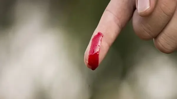 Đứt Tay Và Điềm Báo: Giải Mã Ý Nghĩa Tâm Linh Của Hiện Tượng Chảy Máu