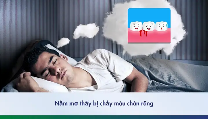 Hình Ảnh Giấc Mơ Chảy Máu Chân Răng Hay Móng Tay Mang Điềm Báo Hình Ảnh Giấc Mơ Chảy Máu Chân Răng Hay Móng Tay Mang Điềm Báo