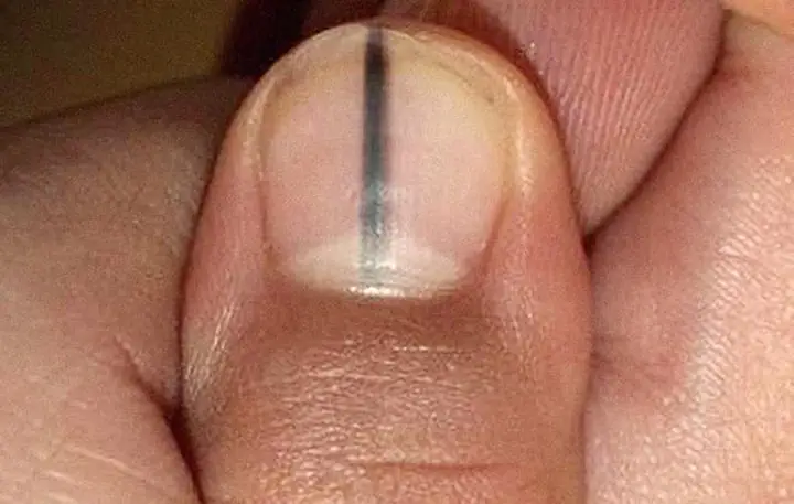 Cách Chăm Sóc Và Bảo Vệ Móng Tay Để Duy Trì Năng Lượng Tích Cực Cách Chăm Sóc Và Bảo Vệ Móng Tay Để Duy Trì Năng Lượng Tích Cực