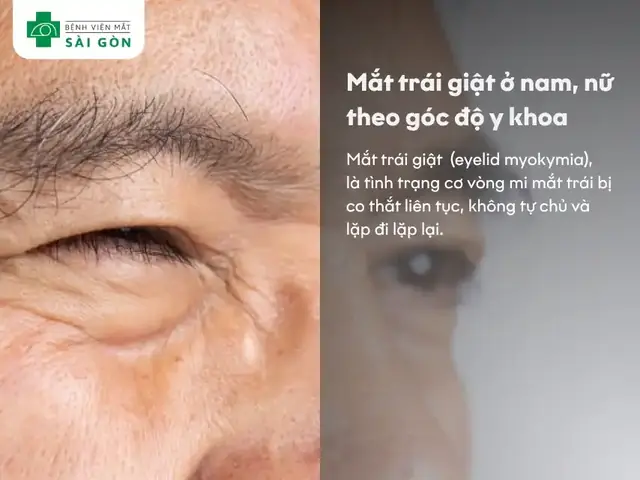 Hiện Tượng Máy Mắt Trái Theo Góc Nhìn Y Khoa Và Đời Sống
