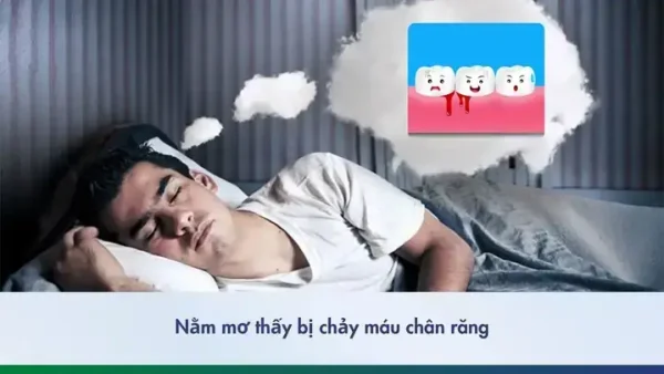 Giải Mã Giấc Mơ Bị Chảy Máu Chân: Ý Nghĩa, Điềm Báo Tốt Xấu Và Con Số May Mắn