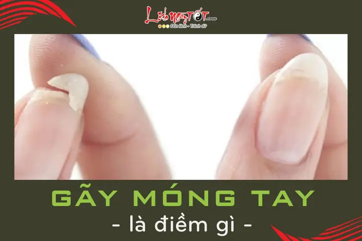 Nằm Mơ Thấy Móng Tay Bị Gãy Là Điềm Báo Gì, Tốt Hay Xấu? Nằm Mơ Thấy Móng Tay Bị Gãy Là Điềm Báo Gì, Tốt Hay Xấu?