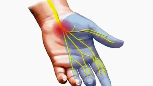 Giải Mã Giấc Mơ Bị Tê Dại Cánh Tay: Ý Nghĩa Điềm Báo Và Nguyên Nhân Sức Khỏe