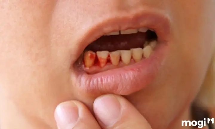 Ngủ Mơ Thấy Đứt Tay Ứng Với Ngón Nào Mang Ý Nghĩa Gì?