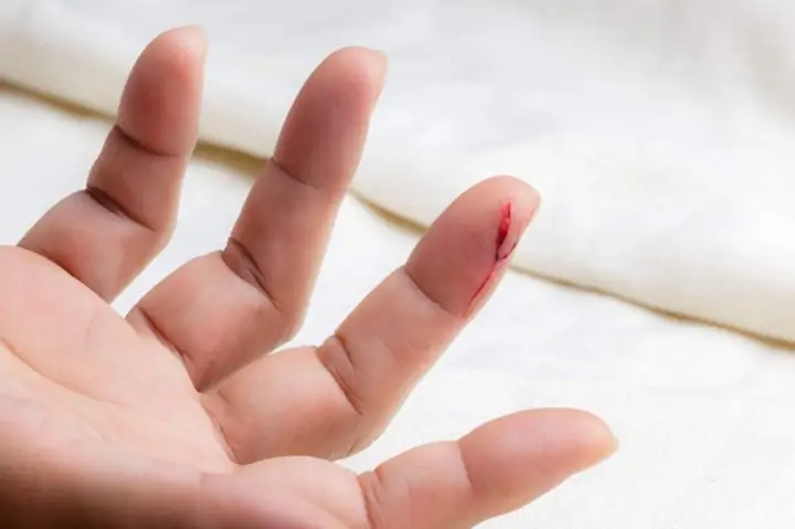 Giải Mã Giấc Mơ Đứt Tay Chảy Máu: Điềm Báo Tốt Hay Xấu Và Ý Nghĩa Thực Tế