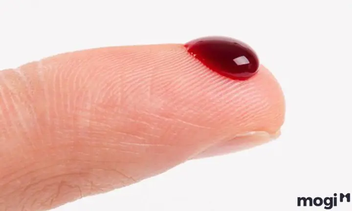 Vết Thương Ở Ngón Áp Út Liên Quan Đến Tình Cảm