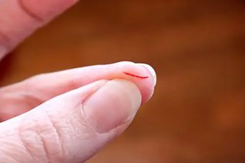 Giải Mã Giấc Mơ Mơ Bị Cắt Tay Chảy Máu: Điềm Báo, Ý Nghĩa Tâm Linh Và Con Số May Mắn