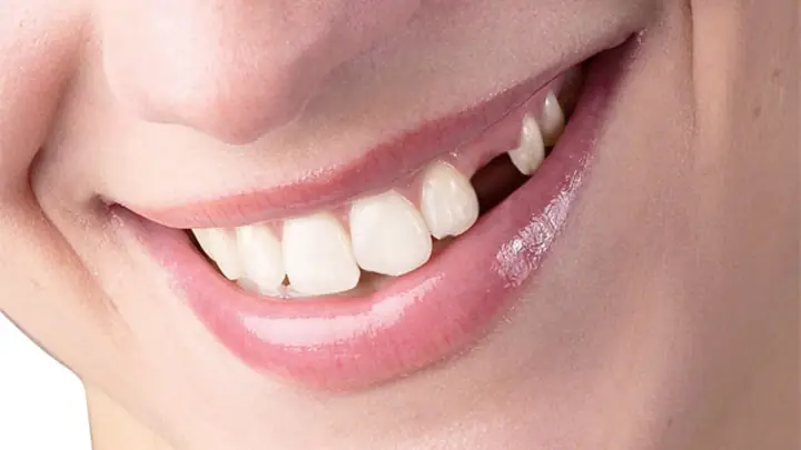Giải Mã Giấc Mơ Rụng Răng Có Máu: Điềm Báo Tâm Linh Và Góc Nhìn Khoa Học Giải Mã Giấc Mơ Rụng Răng Có Máu: Điềm Báo Tâm Linh Và Góc Nhìn Khoa Học