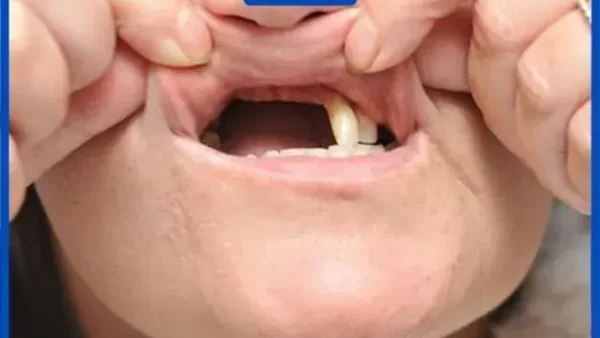Giải Mã Giấc Mơ Rụng Răng Có Máu: Điềm Báo Tâm Linh Và Góc Nhìn Khoa Học