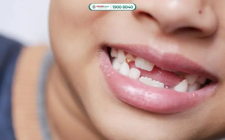 Góc Nhìn Văn Hóa Và Tâm Linh Về Giấc Mơ Gãy Răng Góc Nhìn Văn Hóa Và Tâm Linh Về Giấc Mơ Gãy Răng
