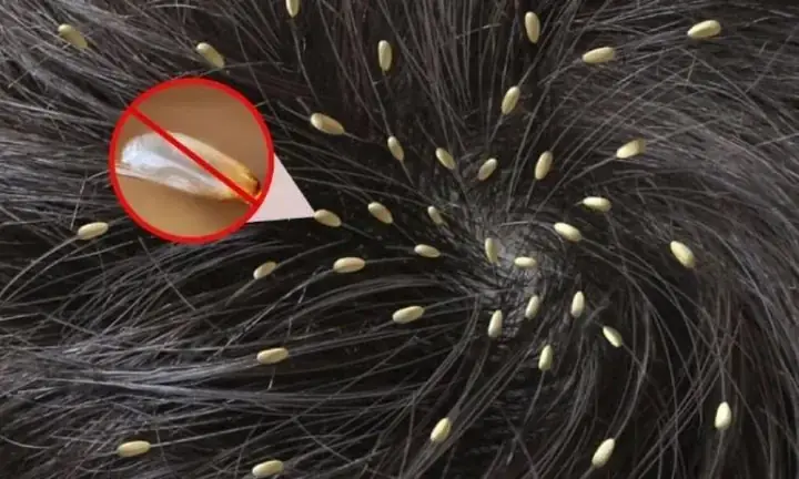 Mơ Thấy Chùa Cháy Có Phải Là Điềm Báo Xui Rủi Hoàn Toàn Không? Mơ Thấy Chùa Cháy Có Phải Là Điềm Báo Xui Rủi Hoàn Toàn Không?