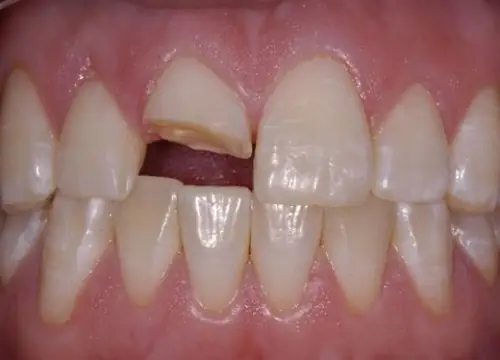 Minh Họa Phản Ánh Về Áp Lực Và Tâm Lý Cá Nhân Căng Thẳng Minh Họa Phản Ánh Về Áp Lực Và Tâm Lý Cá Nhân Căng Thẳng