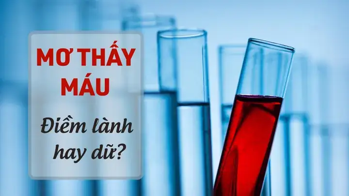 Khi Nào Bạn Cần Tham Khảo Ý Kiến Chuyên Gia Tâm Lý Thay Vì Tìm Kiếm Điềm Báo? Khi Nào Bạn Cần Tham Khảo Ý Kiến Chuyên Gia Tâm Lý Thay Vì Tìm Kiếm Điềm Báo?