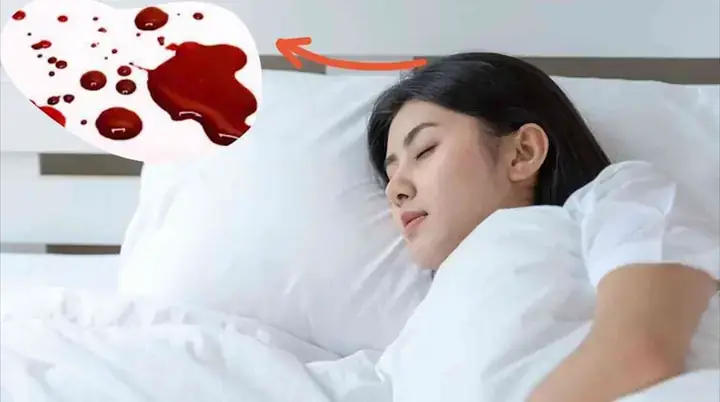 Điềm Báo Chi Tiết Trong Các Tình Huống Mơ Thấy Người Thân Chảy Máu Phổ Biến Điềm Báo Chi Tiết Trong Các Tình Huống Mơ Thấy Người Thân Chảy Máu Phổ Biến