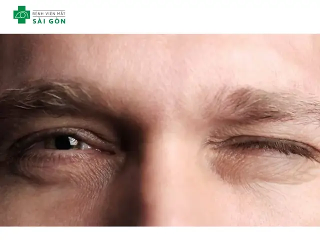 Giải Mã Điềm Báo Giật Mí Mắt Theo Các Khung Giờ Trong Ngày Giải Mã Điềm Báo Giật Mí Mắt Theo Các Khung Giờ Trong Ngày