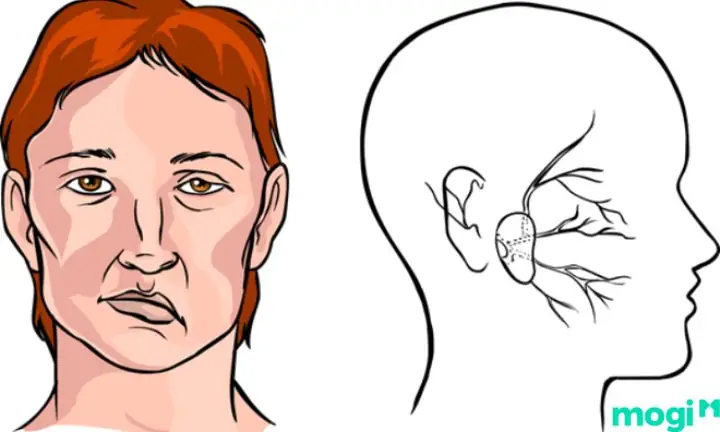 Nguyên Nhân Khoa Học Nào Giải Thích Hiện Tượng Co Giật Cơ Môi Dưới?