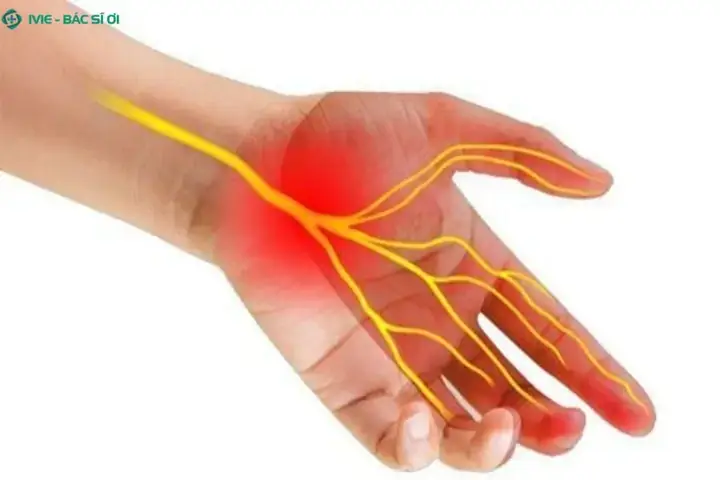Nguyên Nhân Y Khoa Nào Khiến Ngón Tay Út Bị Co Giật Liên Tục? Nguyên Nhân Y Khoa Nào Khiến Ngón Tay Út Bị Co Giật Liên Tục?