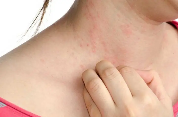 Hắt Xì Hơi Điềm Báo Gì? Giải Mã Ý Nghĩa Nhảy Mũi Theo Ngày Và Giờ Chính Xác Hắt Xì Hơi Điềm Báo Gì? Giải Mã Ý Nghĩa Nhảy Mũi Theo Ngày Và Giờ Chính Xác
