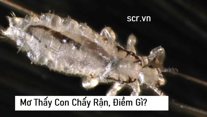Mơ Thấy Bắt Chấy Cho Người Khác Hoặc Người Thân Trong Gia Đình Đánh Số Mấy?